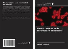 Copertina di Biomarcadores en la enfermedad periodontal