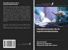Buchcover von Complicaciones de la suprarrenalectomía