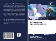 Buchcover von Осложнения адреналэктомии