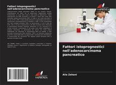 Couverture de Fattori istoprognostici nell'adenocarcinoma pancreatico