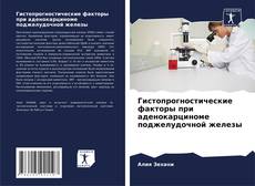 Portada del libro de Гистопрогностические факторы при аденокарциноме поджелудочной железы