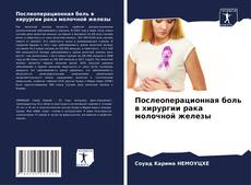 Portada del libro de Послеоперационная боль в хирургии рака молочной железы