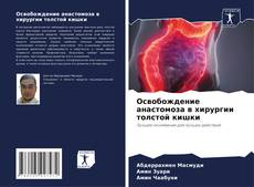 Bookcover of Освобождение анастомоза в хирургии толстой кишки