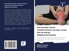 Buchcover von Растяжение связок голеностопного сустава, когда оно не всегда доброкачественное