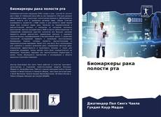Buchcover von Биомаркеры рака полости рта