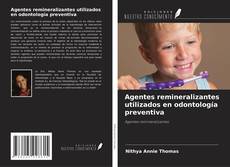 Copertina di Agentes remineralizantes utilizados en odontología preventiva