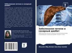 Capa do livro de Заболевания печени и сахарный диабет 