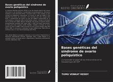 Copertina di Bases genéticas del síndrome de ovario poliquístico