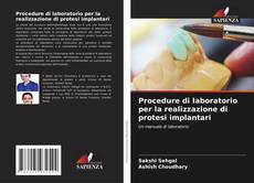 Couverture de Procedure di laboratorio per la realizzazione di protesi implantari