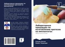 Buchcover von Лабораторные процедуры по изготовлению протезов на имплантатах