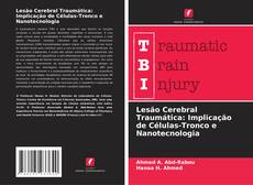 Capa do livro de Lesão Cerebral Traumática: Implicação de Células-Tronco e Nanotecnologia 
