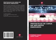 Copertina di PROTOCOLOS DE CARGA EM IMPLANTES ENDÓSSEOS