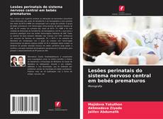 Lesões perinatais do sistema nervoso central em bebés prematuros kitap kapağı