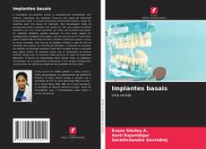 Capa do livro de Implantes basais 