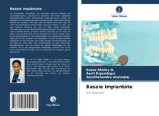 Basale Implantate kitap kapağı