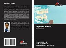 Couverture de Impianti basali