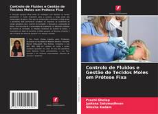 Buchcover von Controlo de Fluidos e Gestão de Tecidos Moles em Prótese Fixa