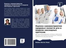 Couverture de Оценка самовосприятия здоровья полости рта в модели накладных протезов