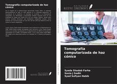 Borítókép a  Tomografía computarizada de haz cónico - hoz