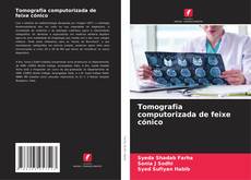 Bookcover of Tomografia computorizada de feixe cónico