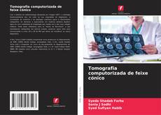 Buchcover von Tomografia computorizada de feixe cónico