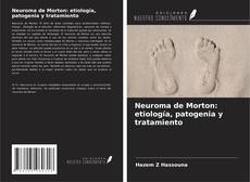 Neuroma de Morton: etiología, patogenia y tratamiento的封面