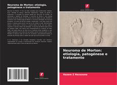Buchcover von Neuroma de Morton: etiologia, patogénese e tratamento