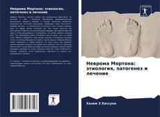 Buchcover von Неврома Мортона: этиология, патогенез и лечение
