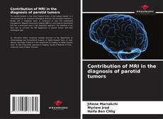 Couverture de Contribution of MRI in the diagnosis of parotid tumors