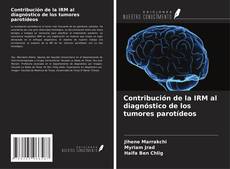 Borítókép a  Contribución de la IRM al diagnóstico de los tumores parotídeos - hoz