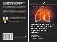 Borítókép a  Sistema automatizado de detección del cáncer de pulmón mediante segmentación de imágenes - hoz