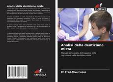 Buchcover von Analisi della dentizione mista