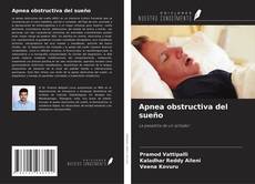 Apnea obstructiva del sueño的封面