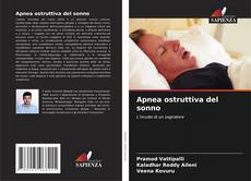 Buchcover von Apnea ostruttiva del sonno