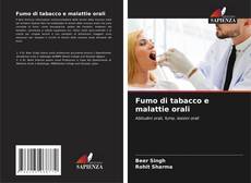 Couverture de Fumo di tabacco e malattie orali