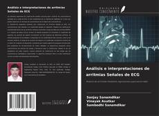 Bookcover of Análisis e interpretaciones de arritmias Señales de ECG