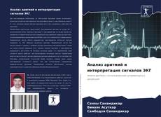 Анализ аритмий и интерпретация сигналов ЭКГ kitap kapağı