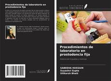 Bookcover of Procedimientos de laboratorio en prostodoncia fija
