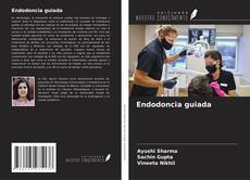 Endodoncia guiada的封面