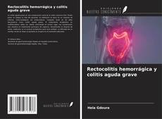 Capa do livro de Rectocolitis hemorrágica y colitis aguda grave 