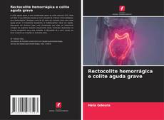 Bookcover of Rectocolite hemorrágica e colite aguda grave