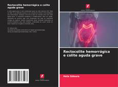 Rectocolite hemorrágica e colite aguda grave的封面