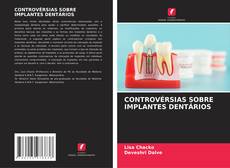 Buchcover von CONTROVÉRSIAS SOBRE IMPLANTES DENTÁRIOS