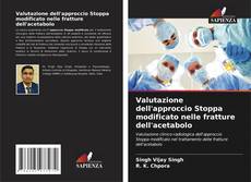 Bookcover of Valutazione dell'approccio Stoppa modificato nelle fratture dell'acetabolo