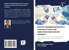 Buchcover von Оценка модифицированного подхода Стоппа при переломах вертлужной впадины