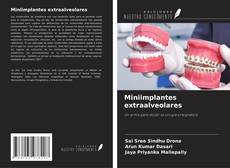 Miniimplantes extraalveolares的封面