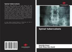 Bookcover of Spinal tuberculosis