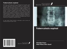 Capa do livro de Tuberculosis espinal 