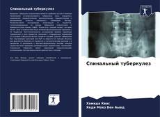 Bookcover of Спинальный туберкулез