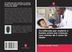 Buchcover von Co-infecção por malária e lesões anais em crianças com menos de 5 anos de idade